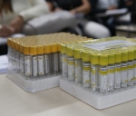 Prefeitura reativa sorologias de HIV, Hepatites e Sífilis, por meio do Laboratório Municipal